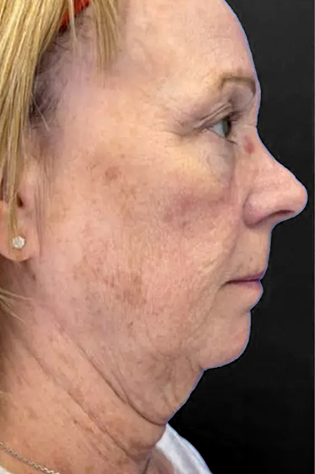 before and after image