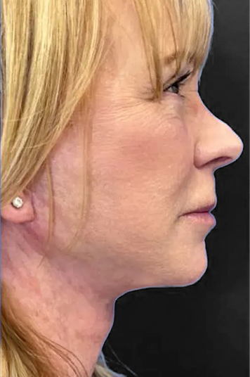 before and after image