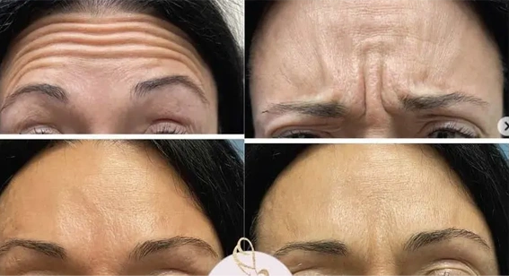 Real patient results before and after plastic surgery results in Long Island, NY, performed by Dr. Sotirios Papafragkou.