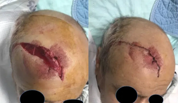 Real patient results before and after plastic surgery results in Long Island, NY, performed by Dr. Sotirios Papafragkou.