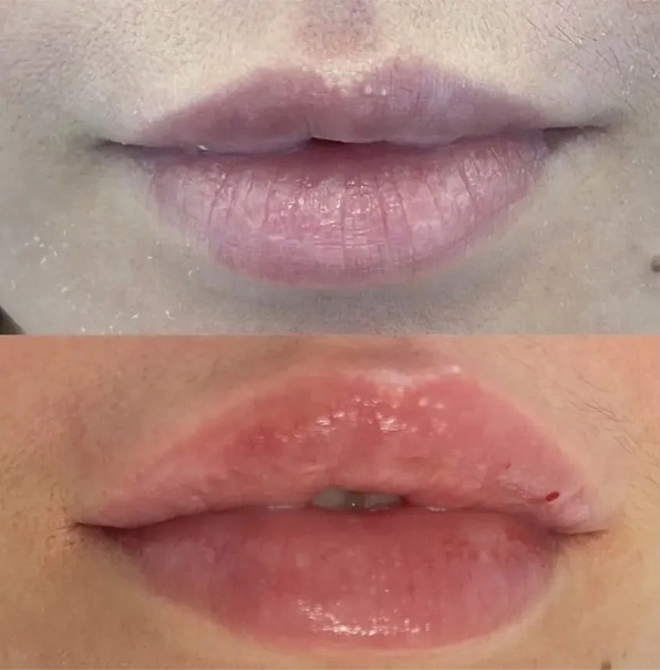 Real patient results before and after plastic surgery results in Long Island, NY, performed by Dr. Sotirios Papafragkou.