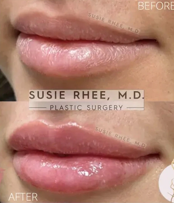 Real patient results before and after plastic surgery results in Long Island, NY, performed by Dr. Sotirios Papafragkou.