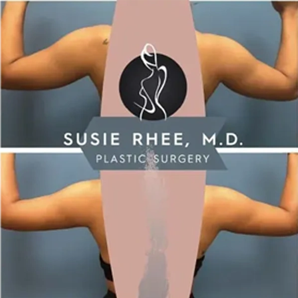 Real patient results before and after plastic surgery results in Long Island, NY, performed by Dr. Sotirios Papafragkou.