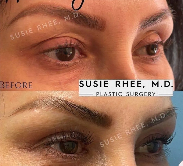 Real patient results before and after plastic surgery results in Long Island, NY, performed by Dr. Sotirios Papafragkou.