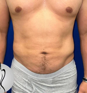 01-A-male-plastic-preview