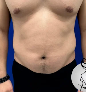 01-B-male-plastic-preview