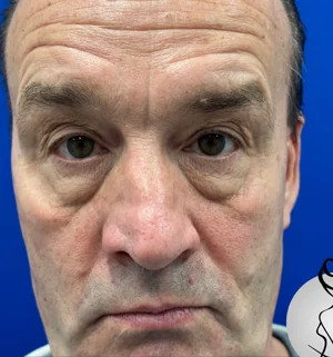 02-B-male-plastic-preview