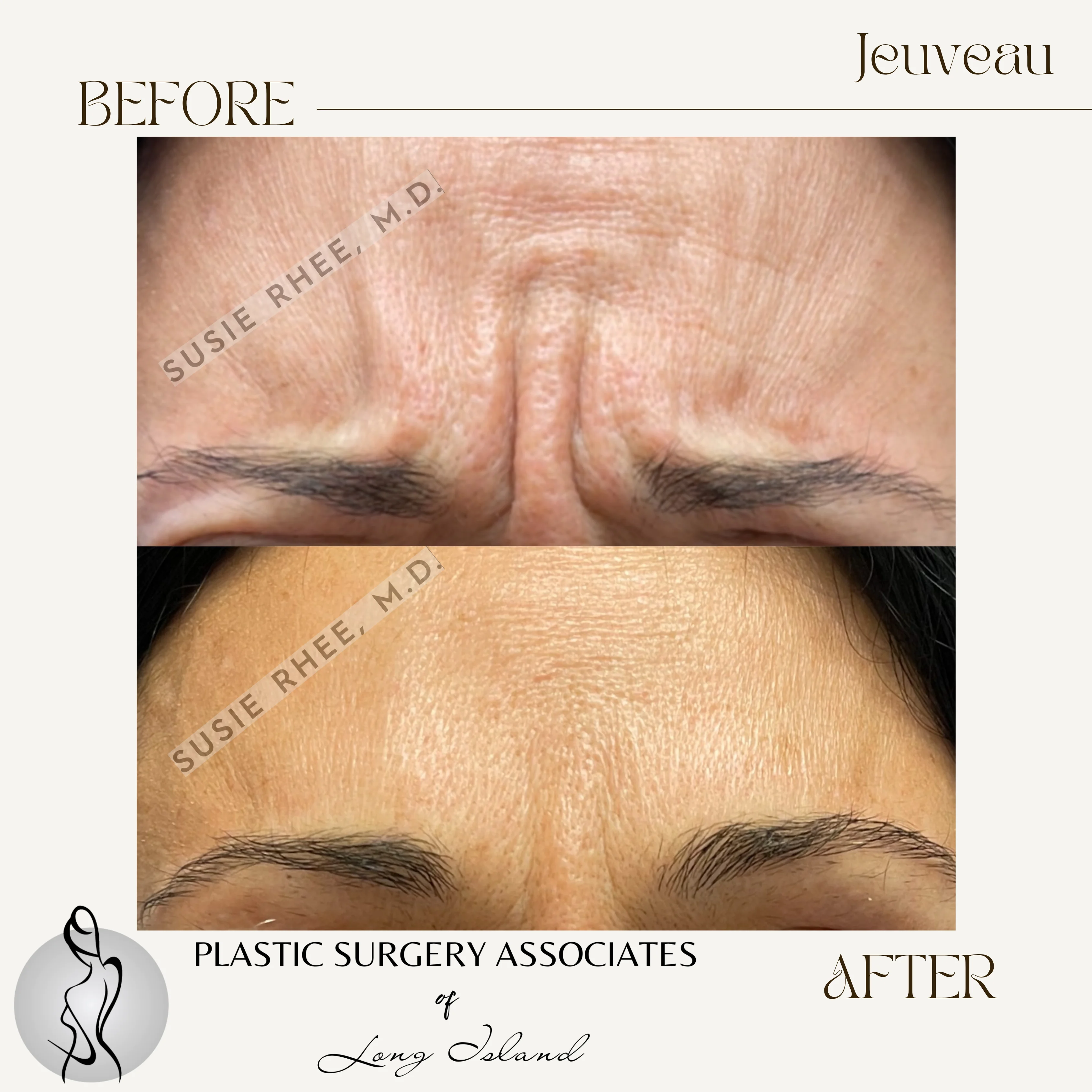 Beige Brown Neutral Before + After Instagram Post – 2