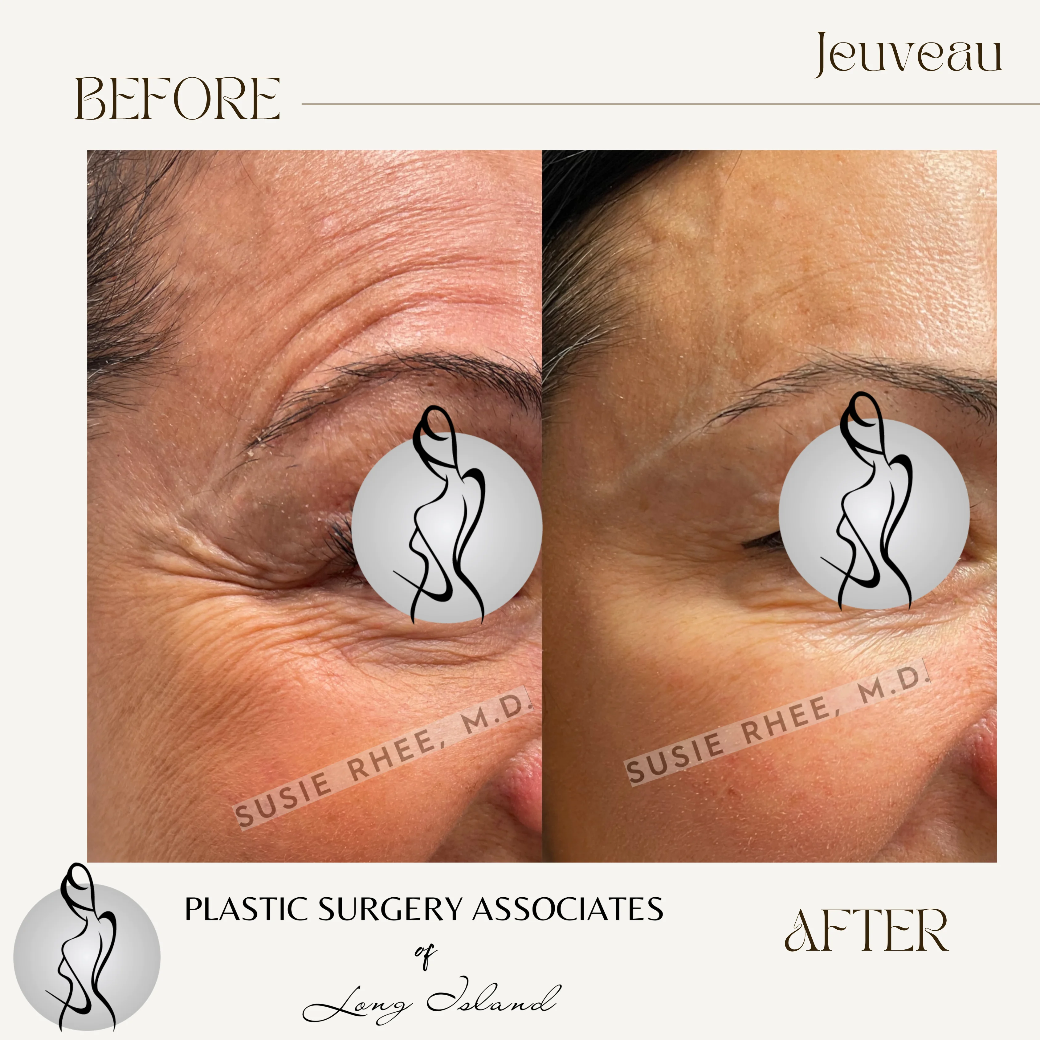 Beige Brown Neutral Before + After Instagram Post – 3