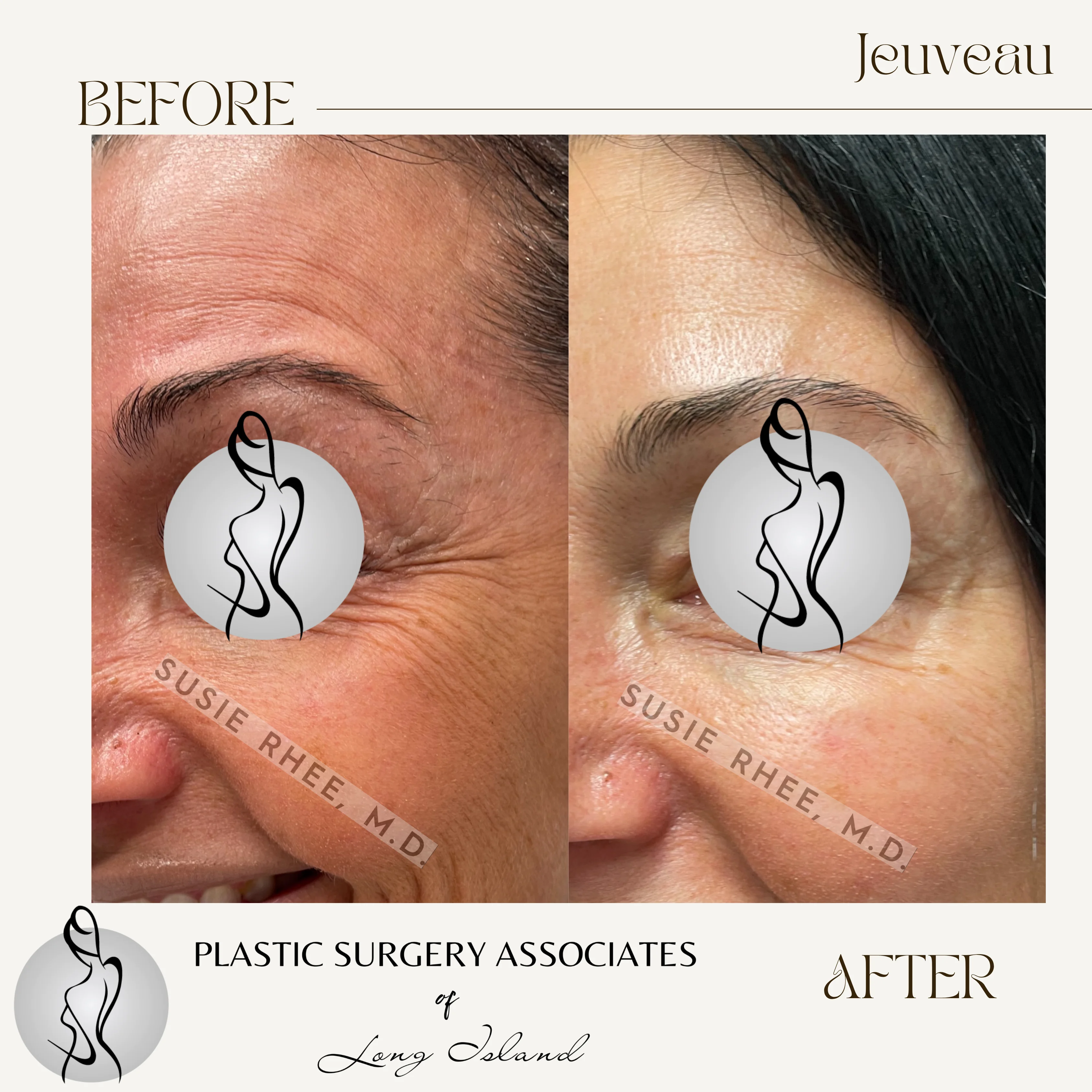 Beige Brown Neutral Before + After Instagram Post – 4