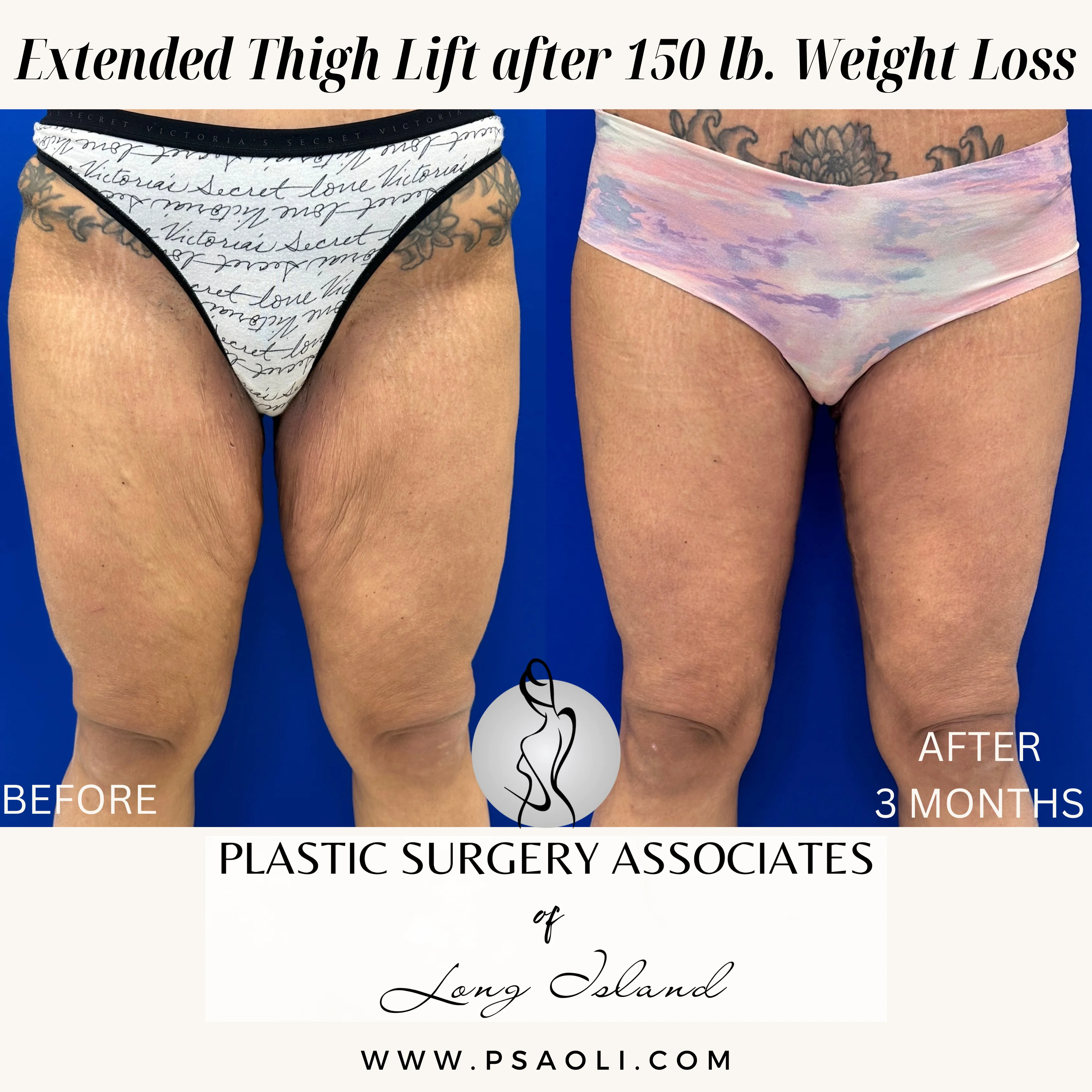 Beige Minimalist Stay Tuned Coming Soon Instagram Post – 1