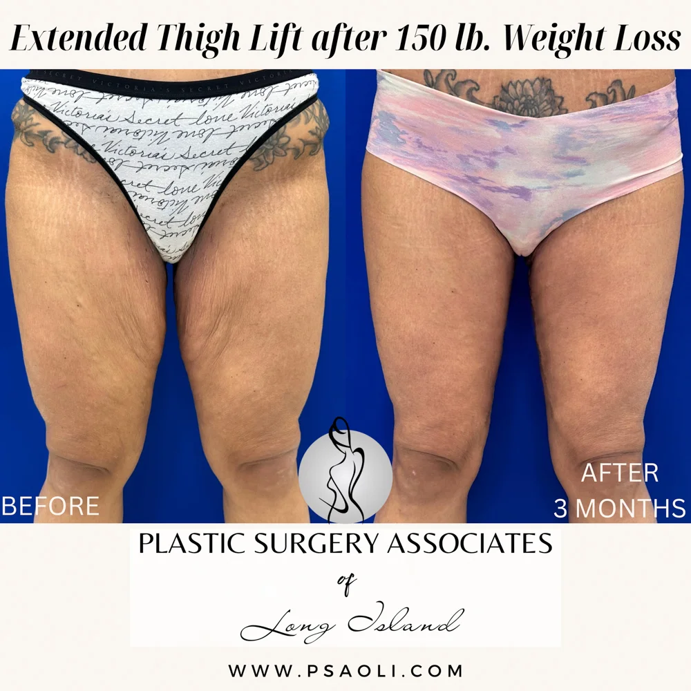 Beige Minimalist Stay Tuned Coming Soon Instagram Post – 1