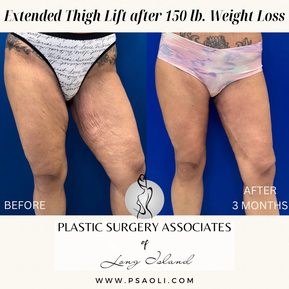 Beige Minimalist Stay Tuned Coming Soon Instagram Post – 2