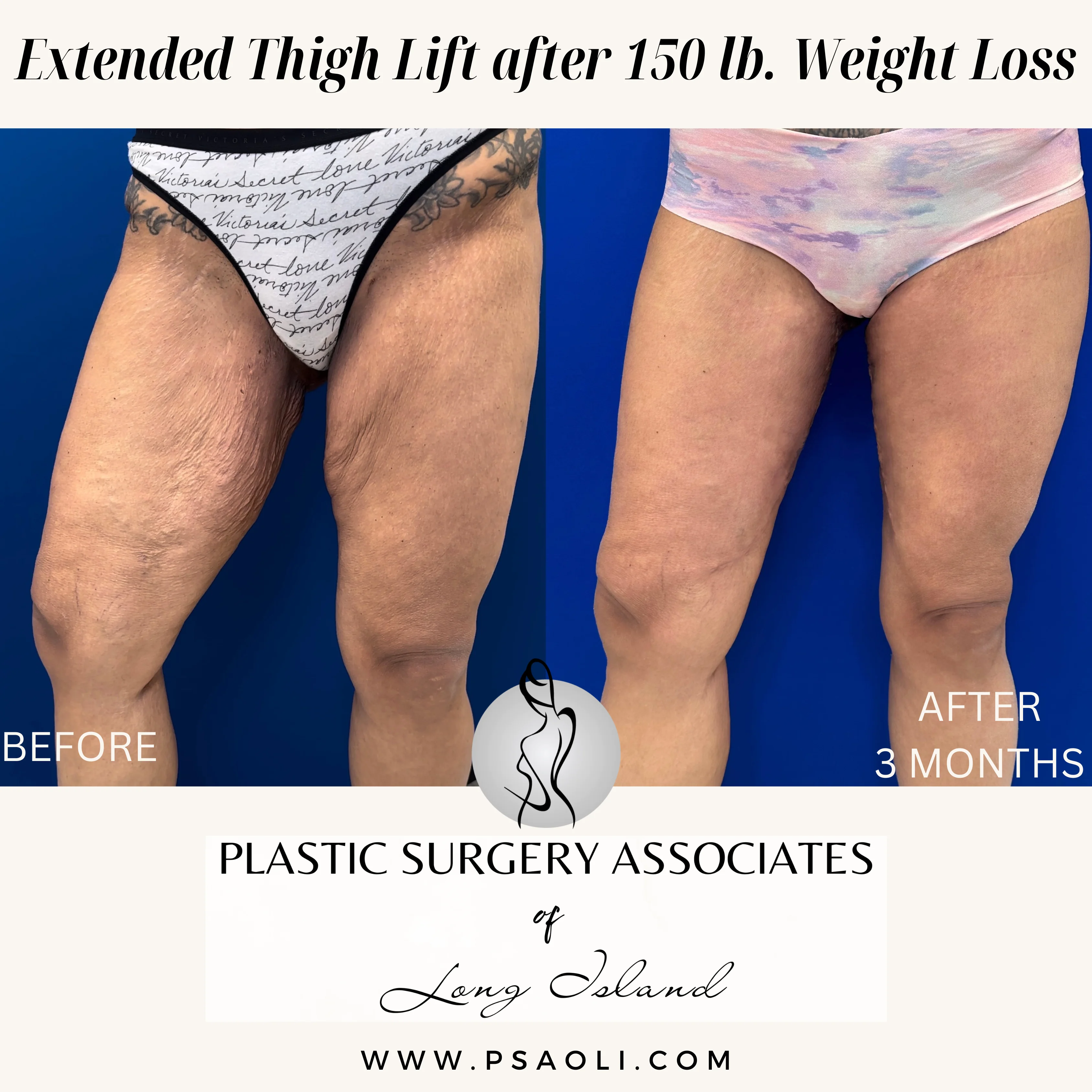 Beige Minimalist Stay Tuned Coming Soon Instagram Post – 3