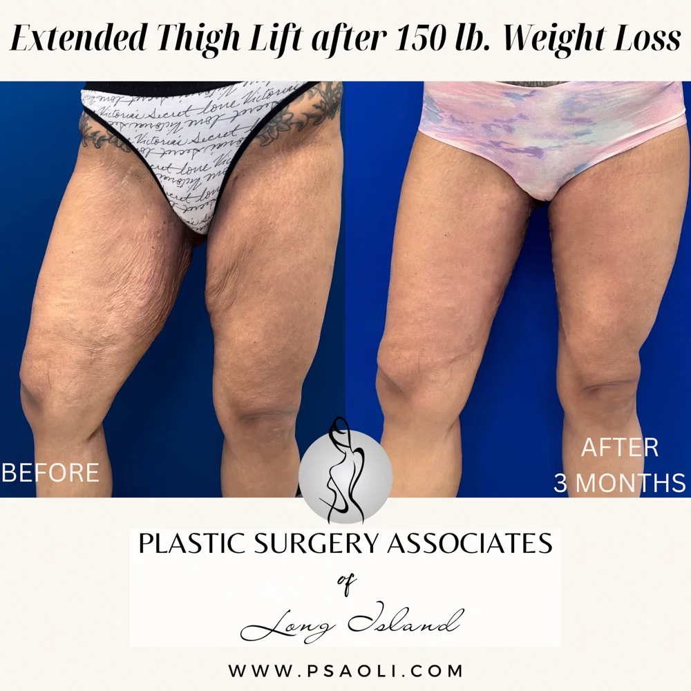 Beige Minimalist Stay Tuned Coming Soon Instagram Post – 3