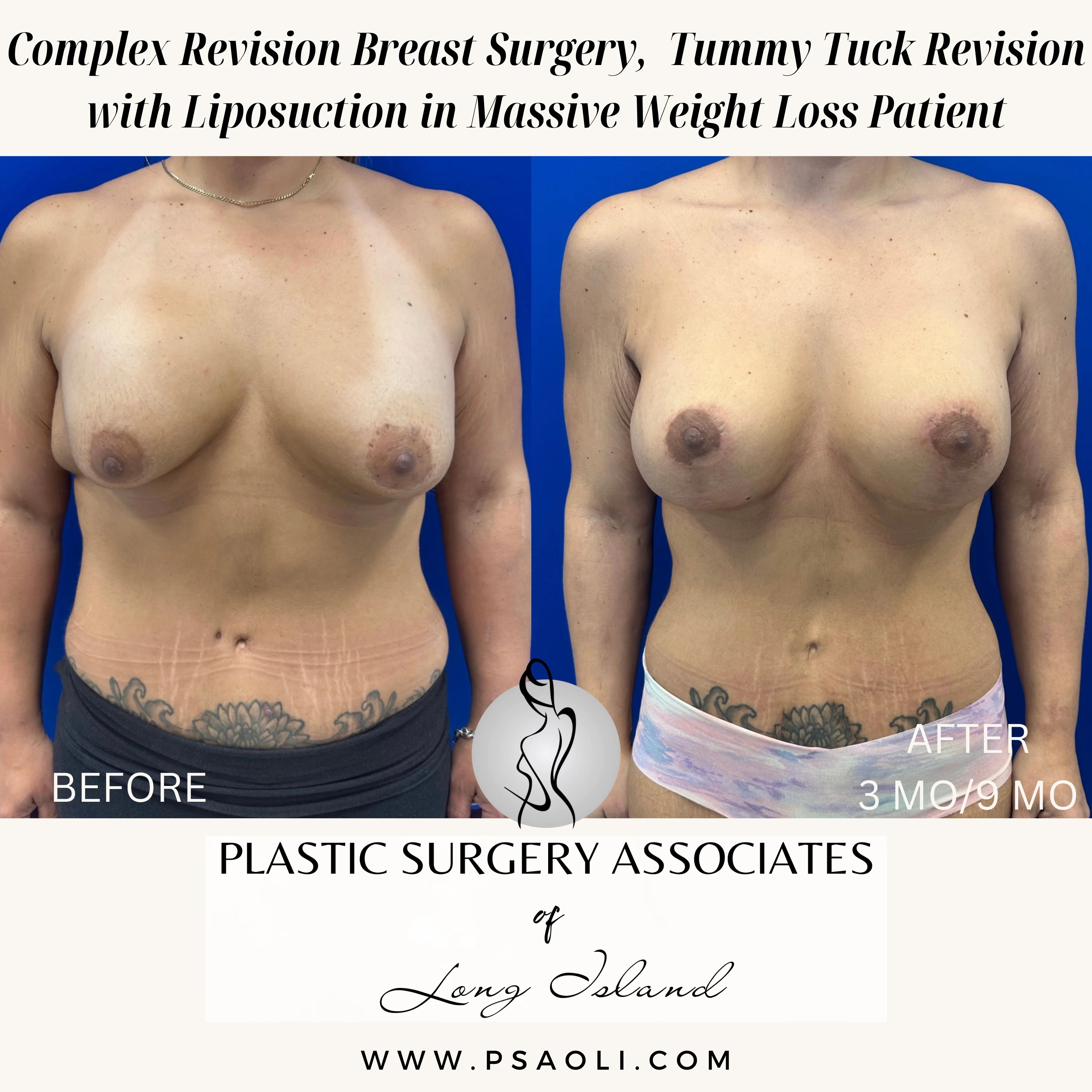 Beige Minimalist Stay Tuned Coming Soon Instagram Post – 4