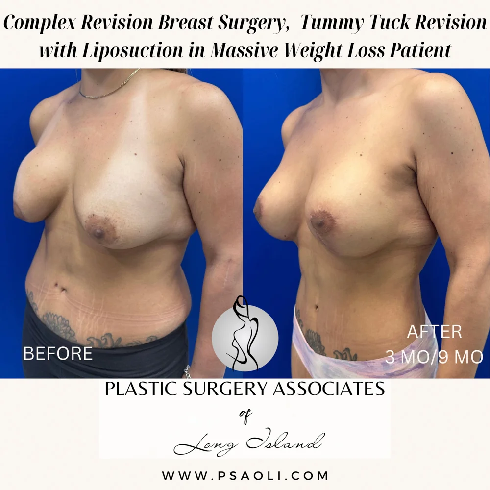 Beige Minimalist Stay Tuned Coming Soon Instagram Post – 5