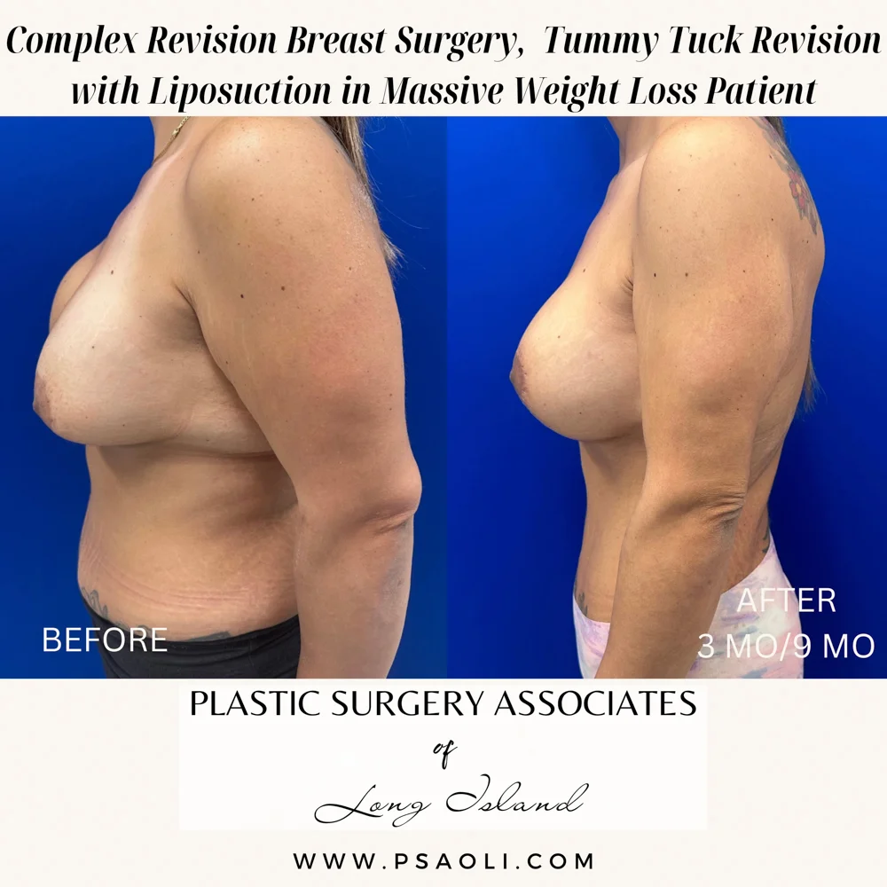 Beige Minimalist Stay Tuned Coming Soon Instagram Post – 6