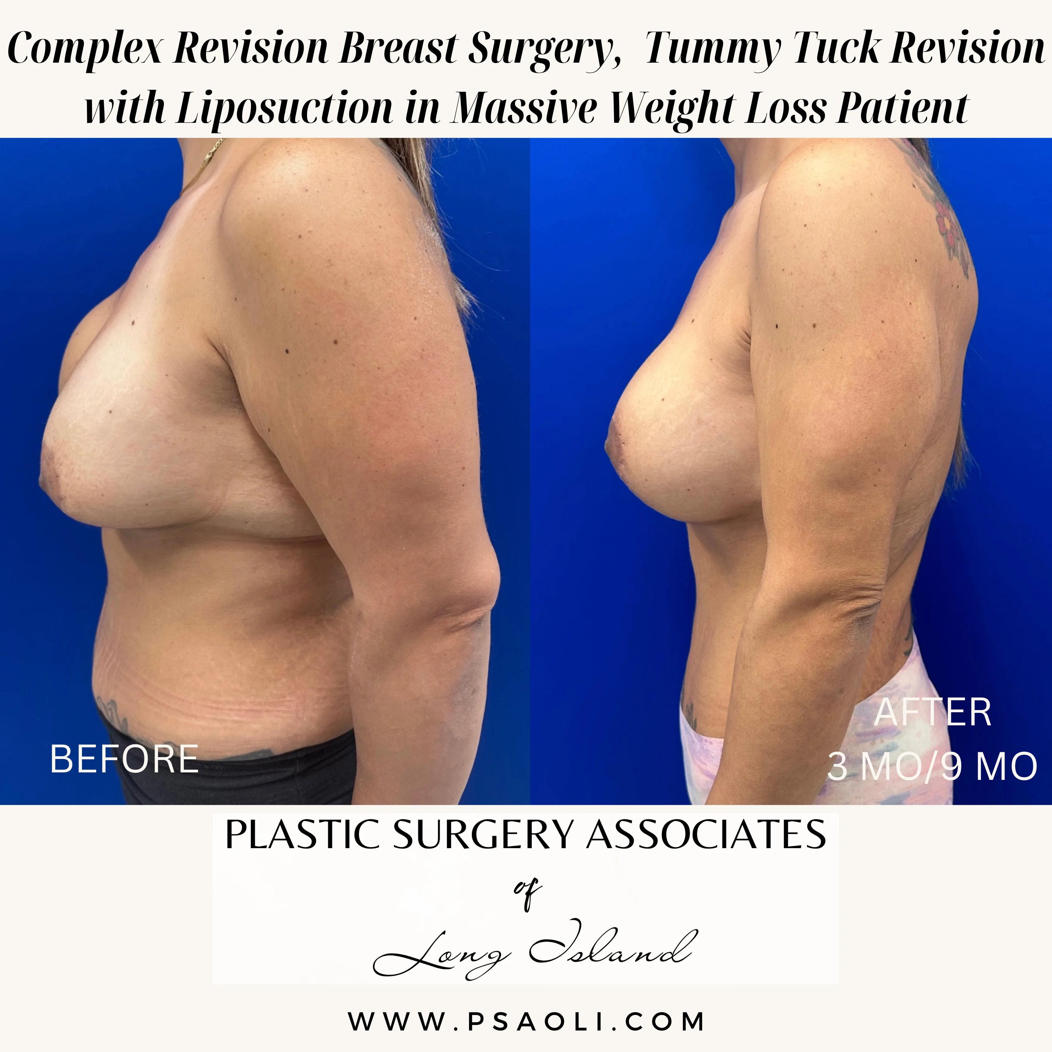 Beige Minimalist Stay Tuned Coming Soon Instagram Post – 6