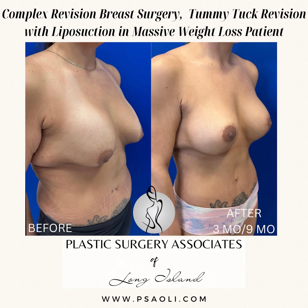 Beige Minimalist Stay Tuned Coming Soon Instagram Post – 7