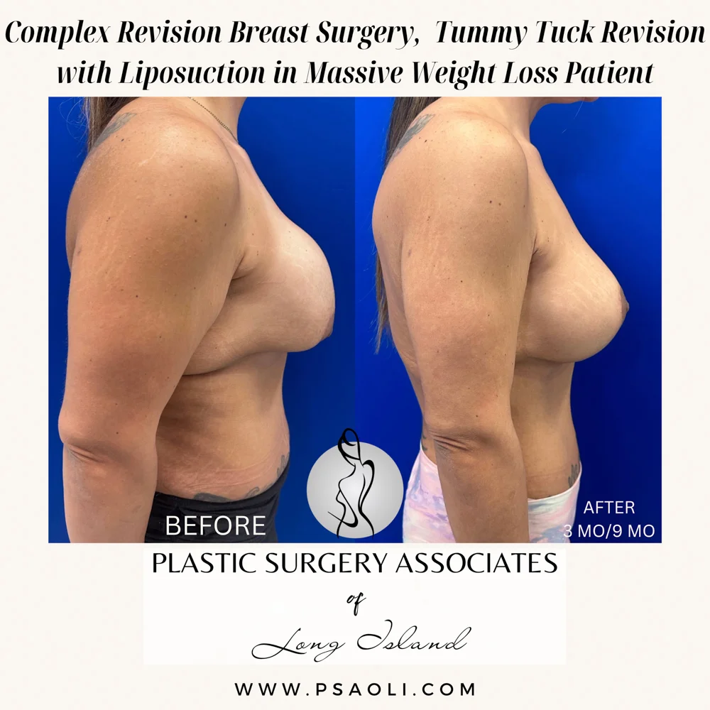 Beige Minimalist Stay Tuned Coming Soon Instagram Post – 8