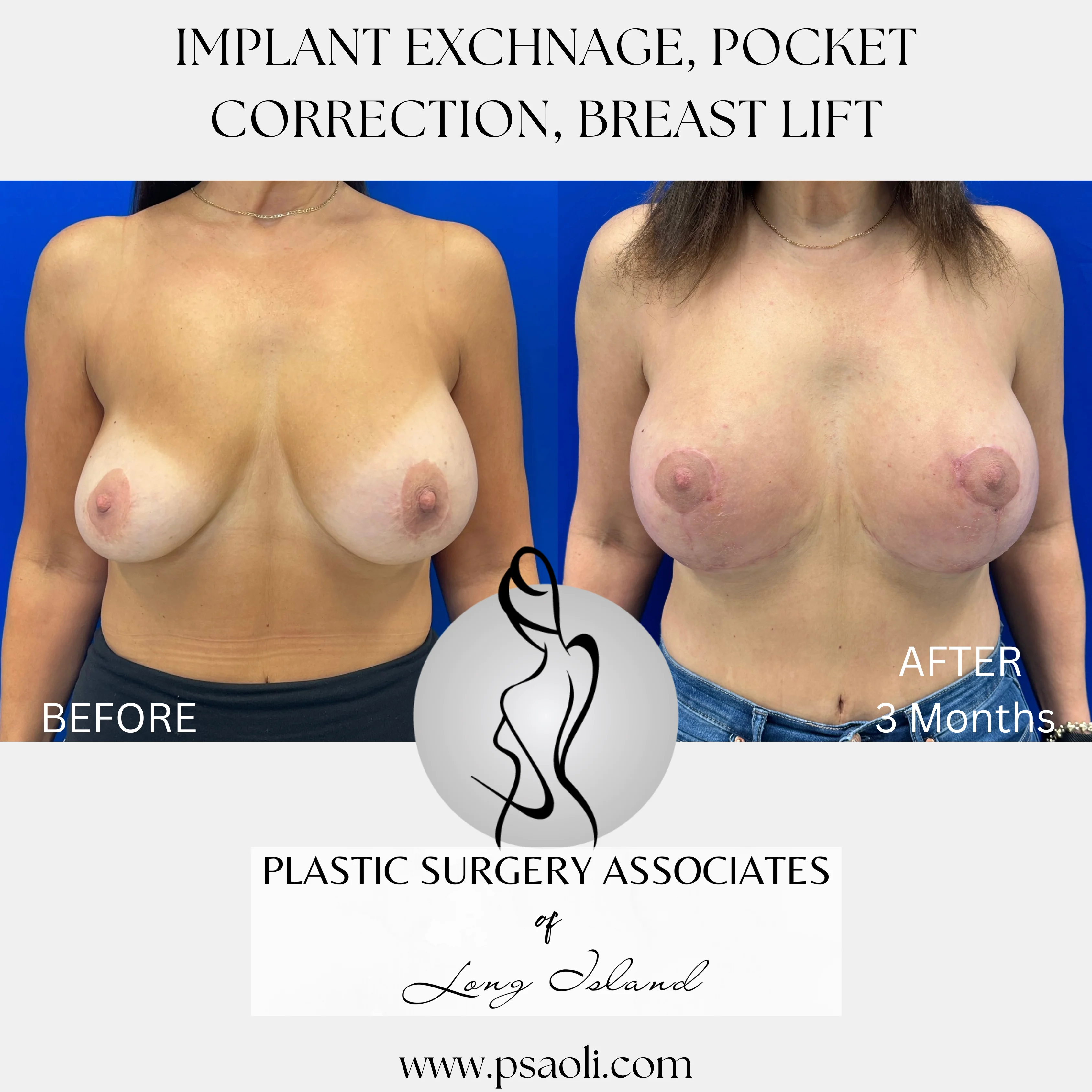 Beige Neutral Aesthetic Photo Collage Frame Mood Board Lifestyle Instagram Post – 1