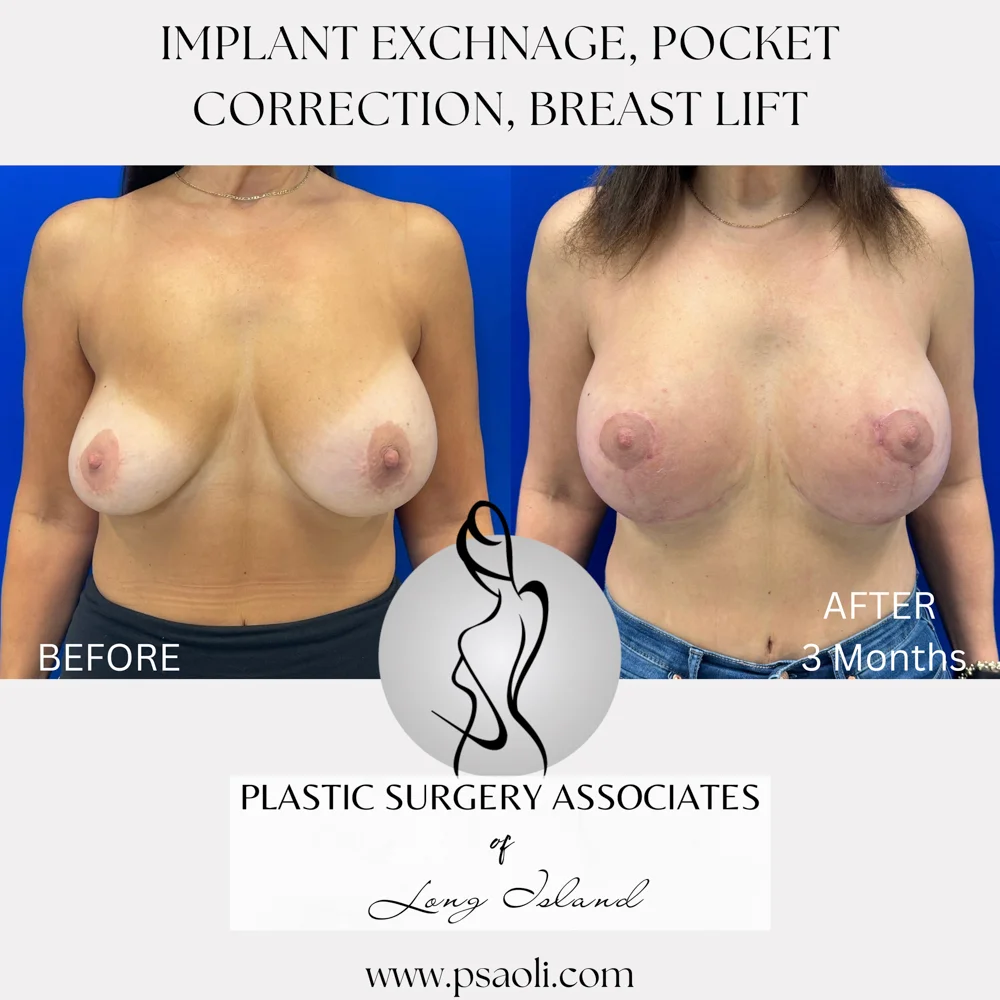 Beige Neutral Aesthetic Photo Collage Frame Mood Board Lifestyle Instagram Post – 1