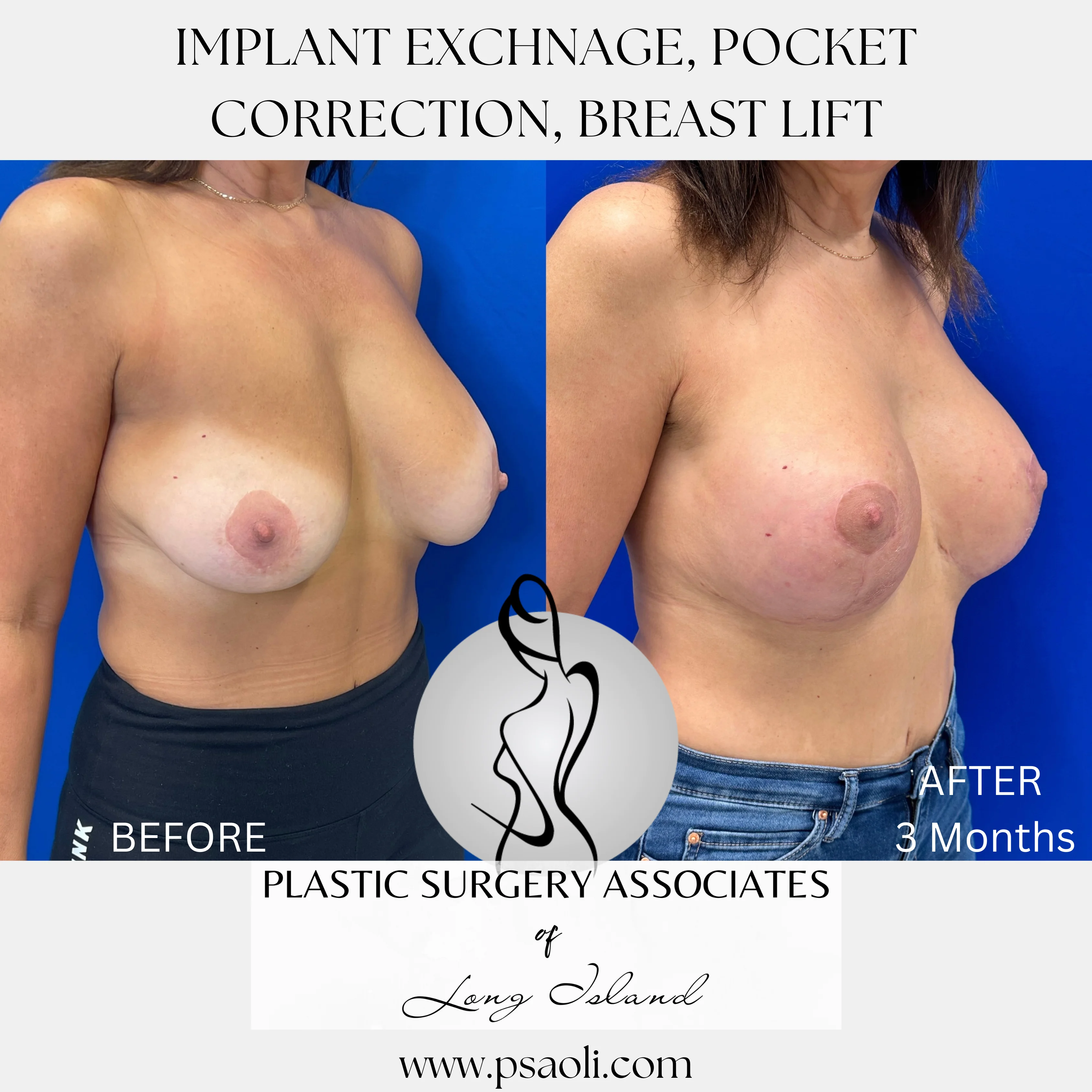 Beige Neutral Aesthetic Photo Collage Frame Mood Board Lifestyle Instagram Post – 2