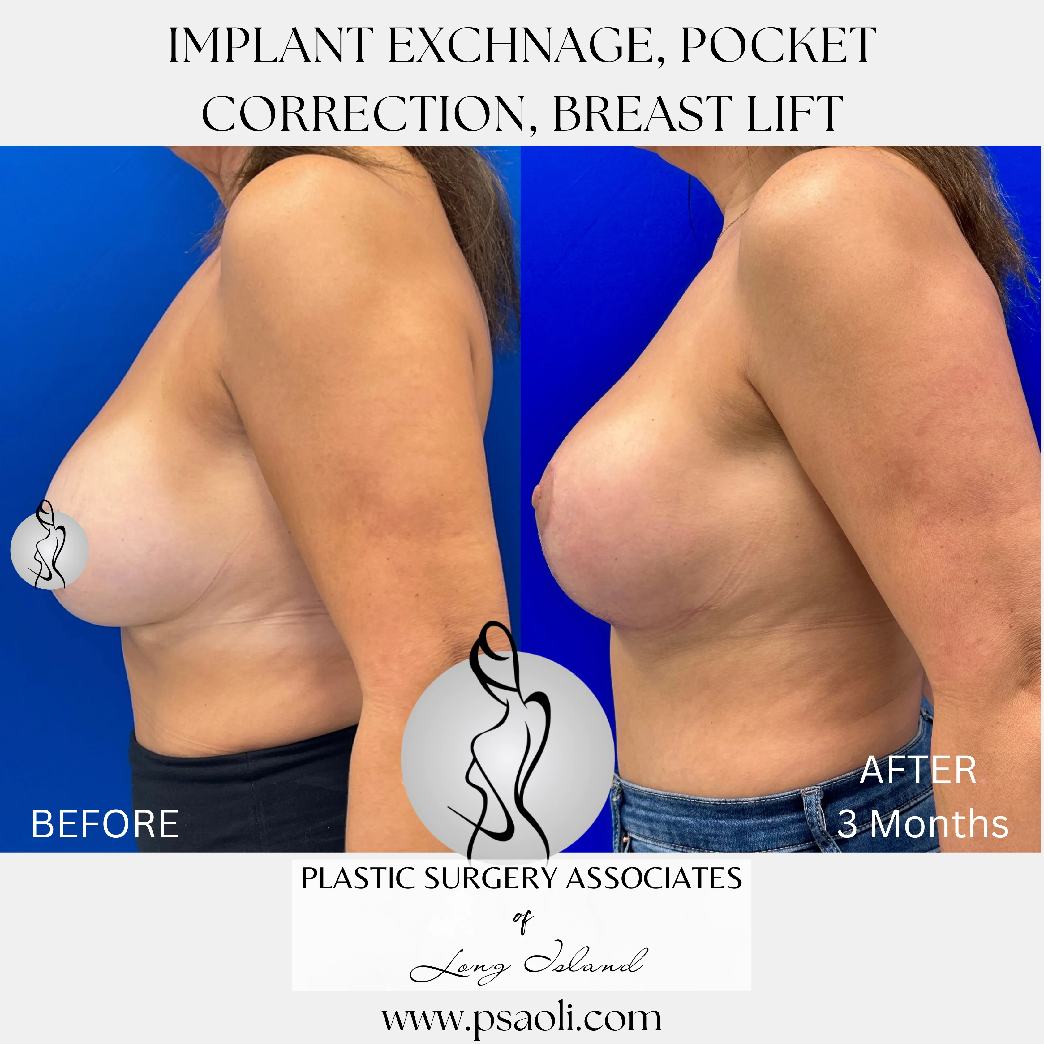 Beige Neutral Aesthetic Photo Collage Frame Mood Board Lifestyle Instagram Post – 5