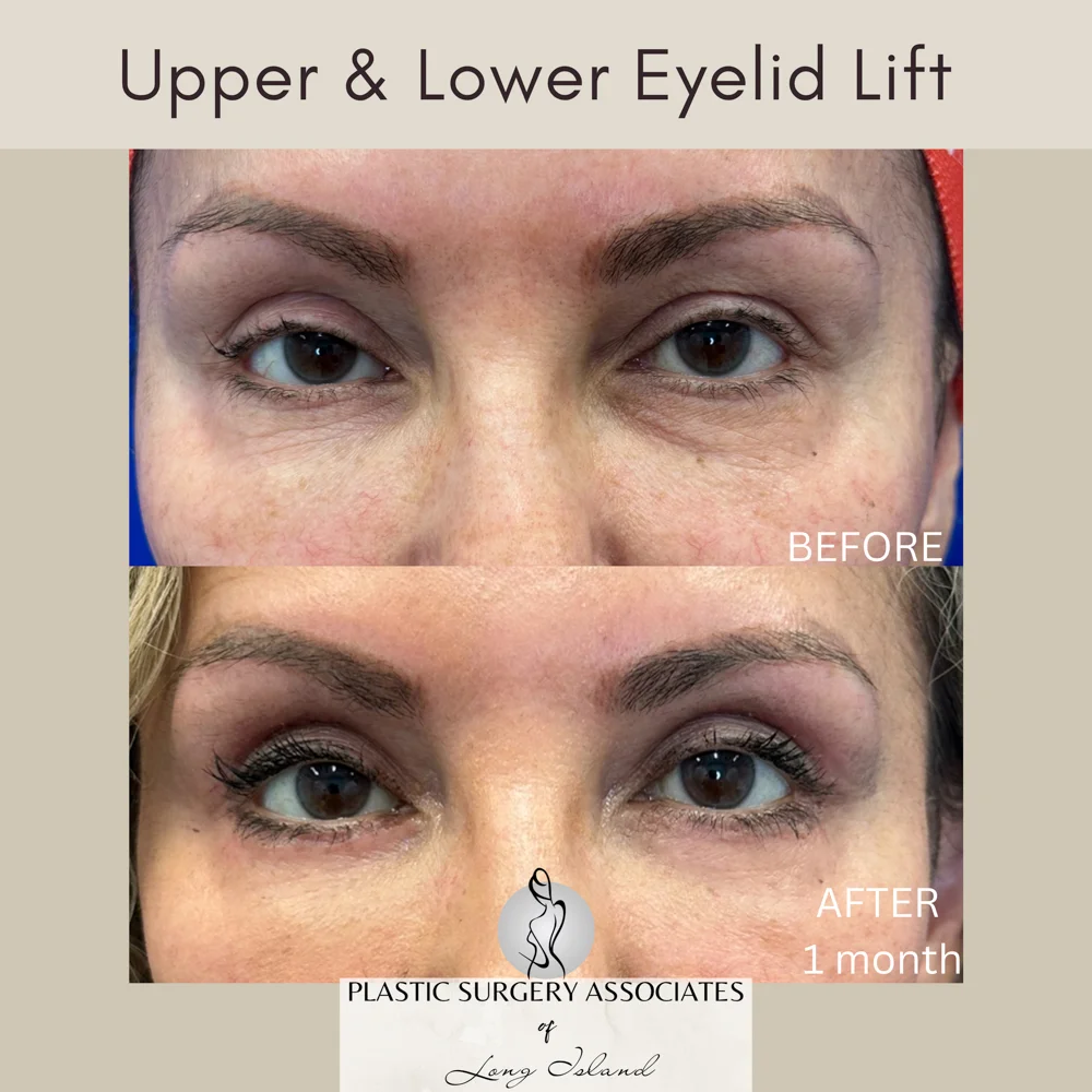 Beige and Gray Quote Health and Wellness Square Instagram Post – 1