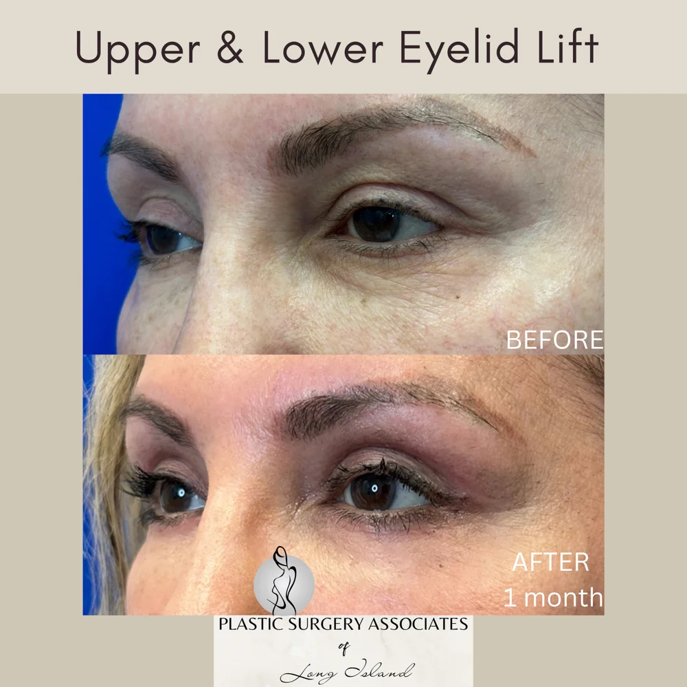 Beige and Gray Quote Health and Wellness Square Instagram Post – 2