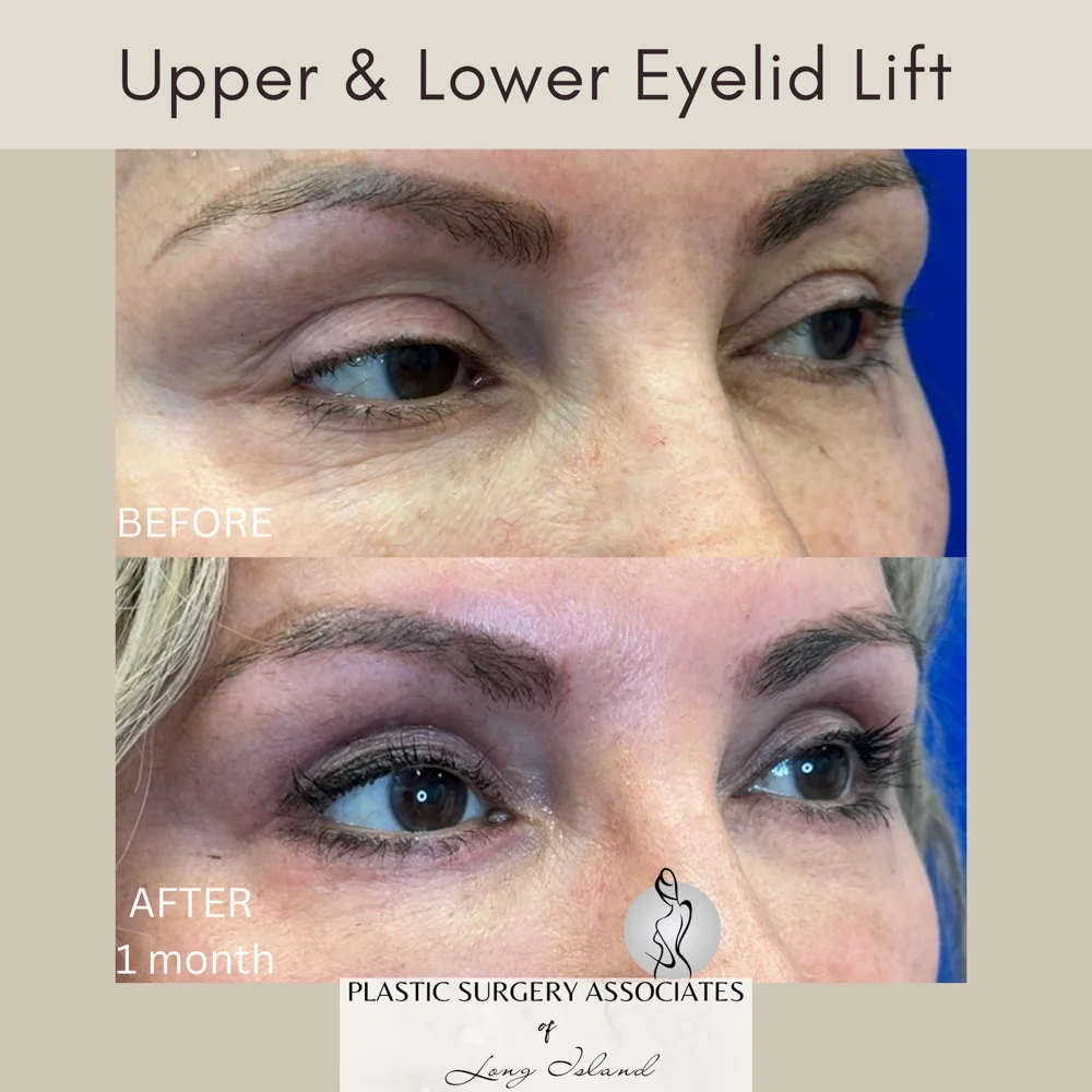 Beige and Gray Quote Health and Wellness Square Instagram Post – 3