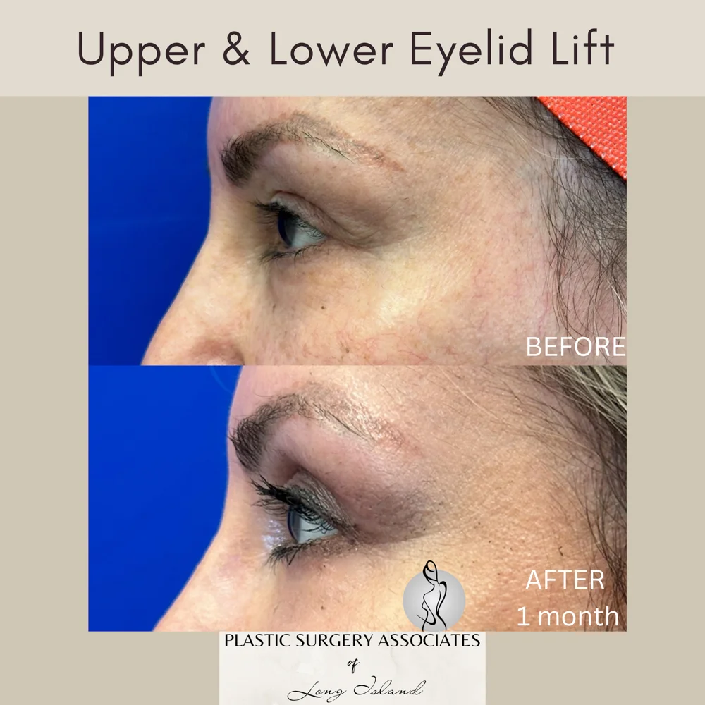 Beige and Gray Quote Health and Wellness Square Instagram Post – 4