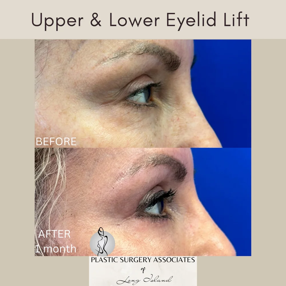 Beige and Gray Quote Health and Wellness Square Instagram Post – 5