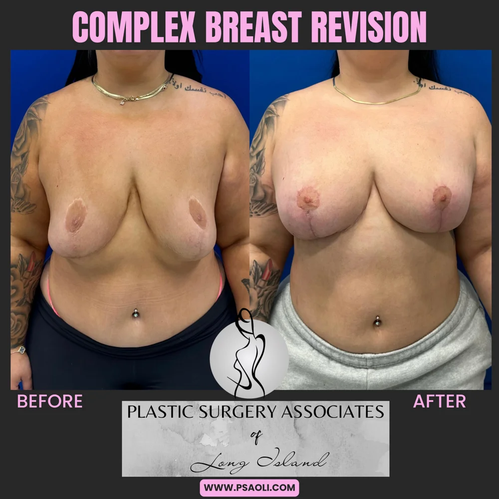 Black Pink Bold and Simple Business Tip Instagram Post – tips