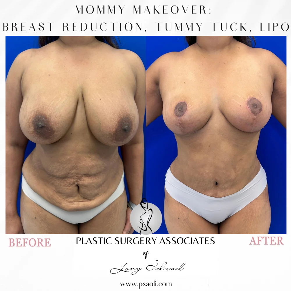 Black & White Simple Coming Soon Instagram Post (Square) – 1