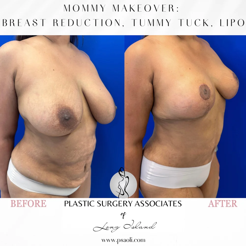 Black & White Simple Coming Soon Instagram Post (Square) – 2