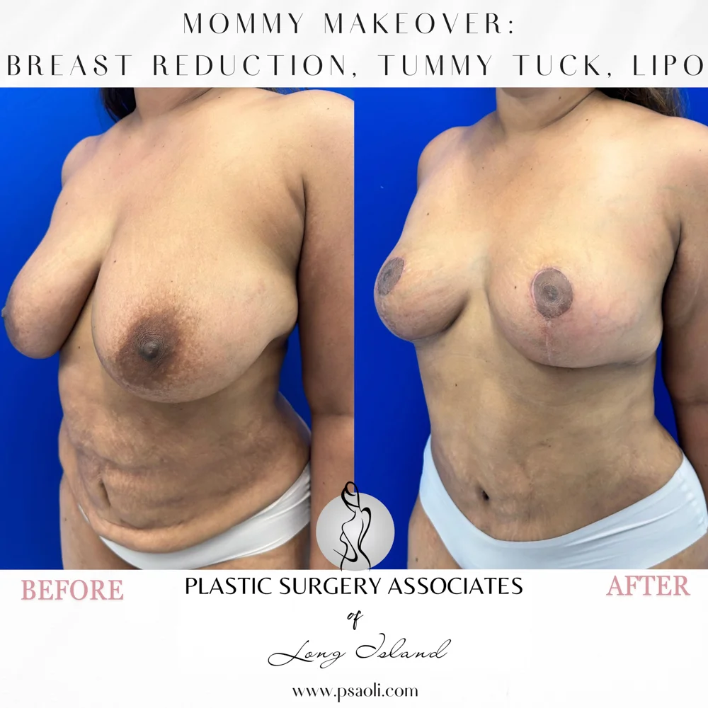 Black & White Simple Coming Soon Instagram Post (Square) – 3