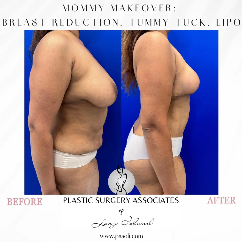 Black & White Simple Coming Soon Instagram Post (Square) – 4