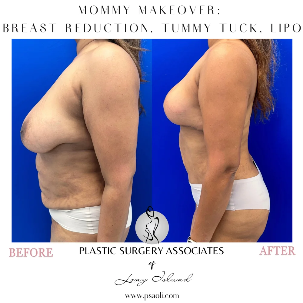 Black & White Simple Coming Soon Instagram Post (Square) – 5