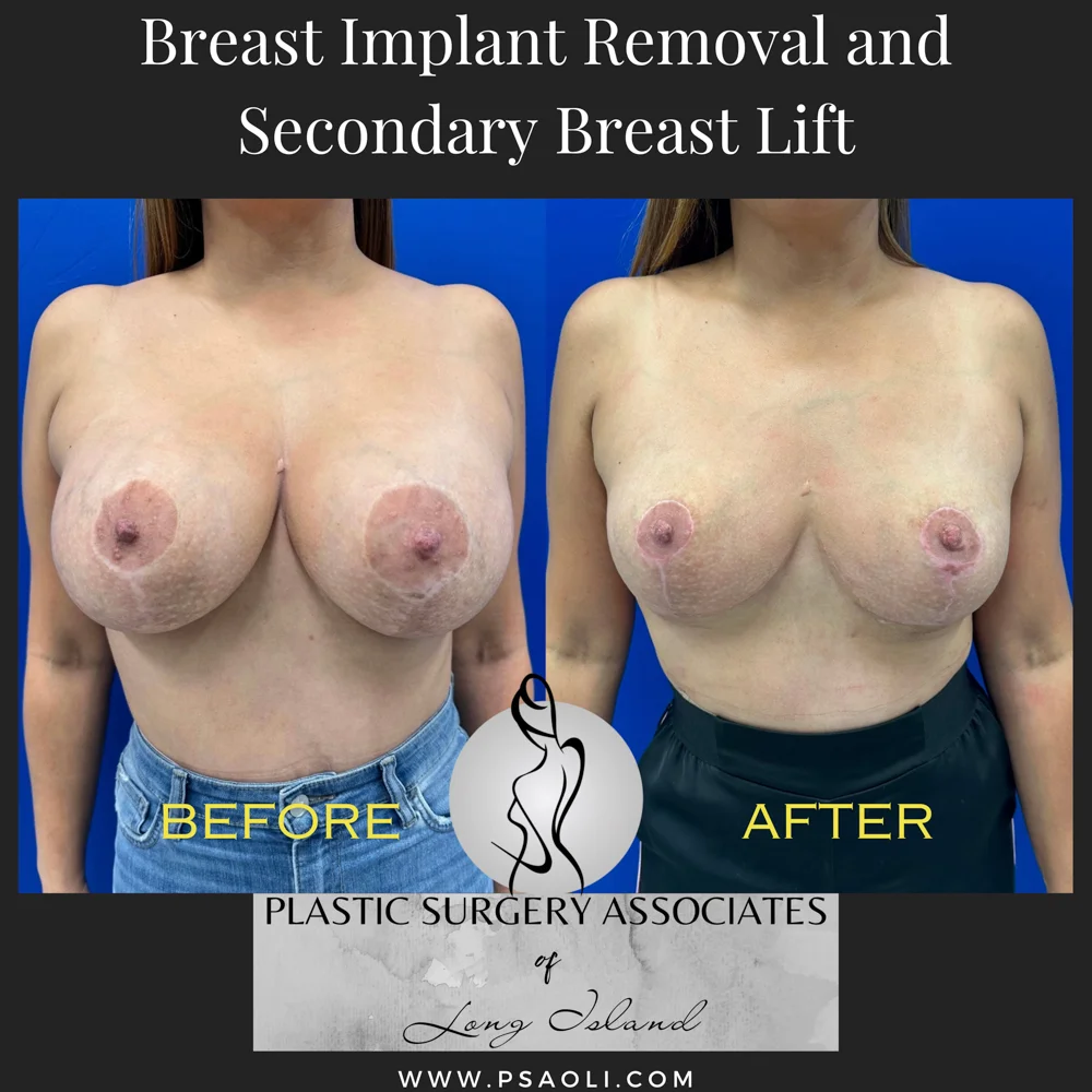 Black White Simple Quote Instagram Post – 1