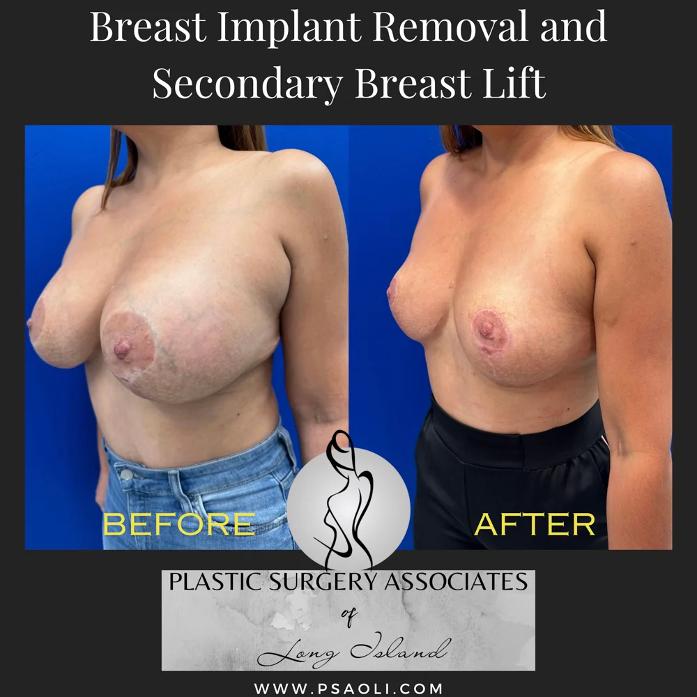 Black White Simple Quote Instagram Post – 2