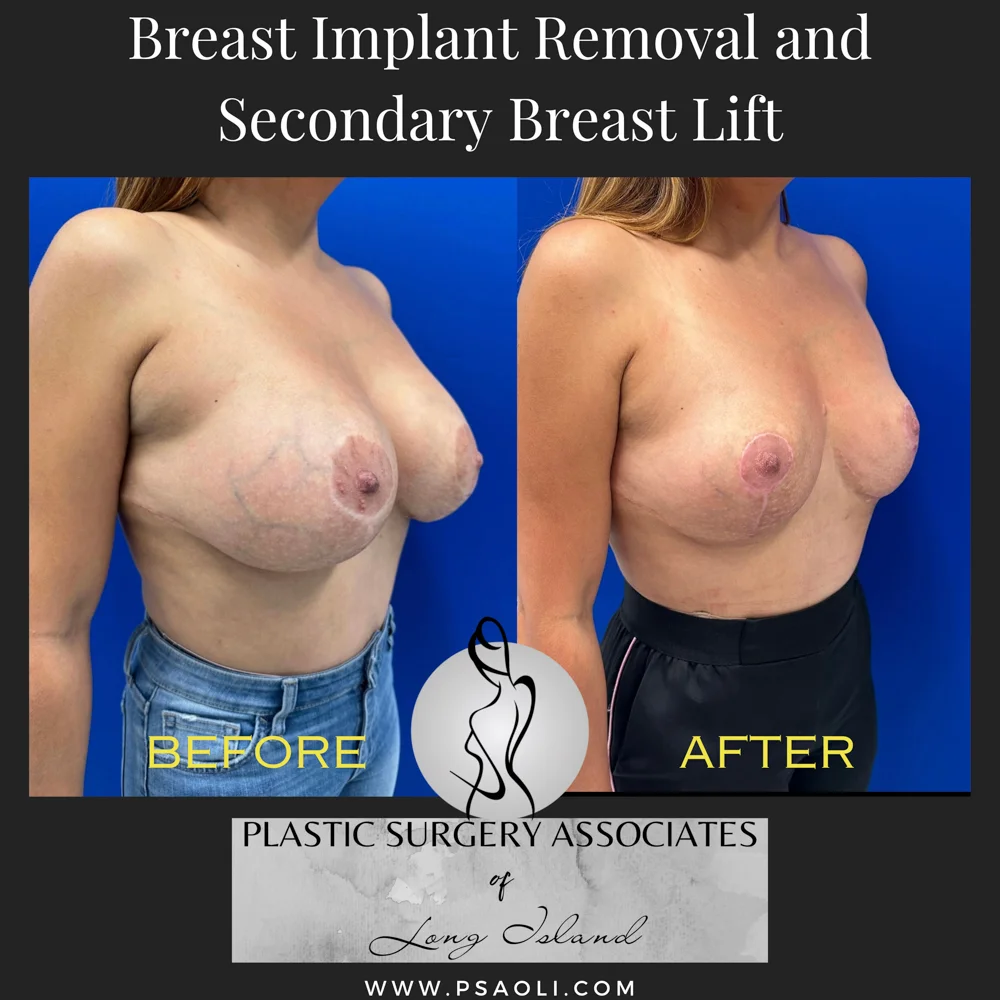 Black White Simple Quote Instagram Post – 3