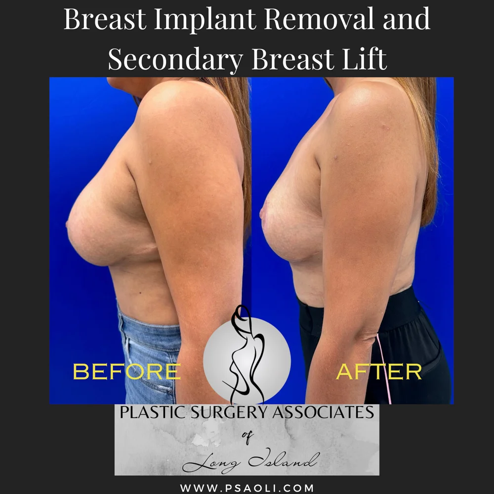 Black White Simple Quote Instagram Post – 4