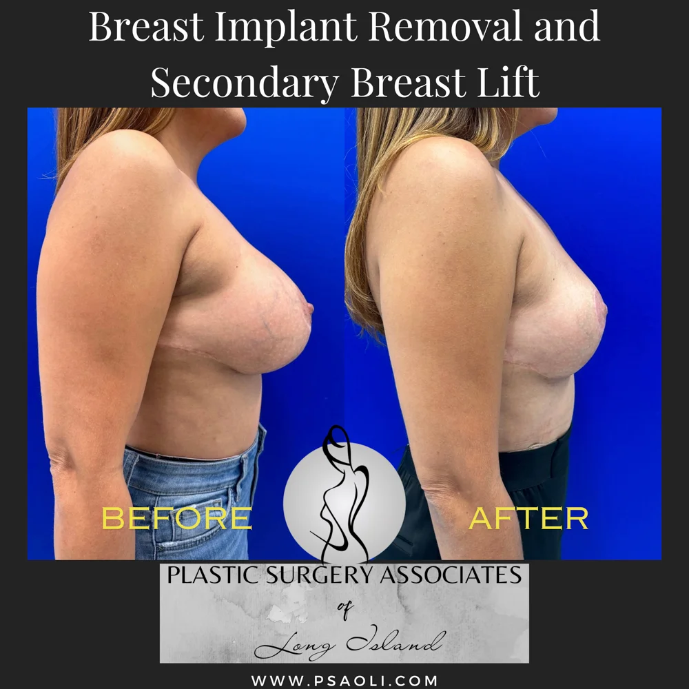 Black White Simple Quote Instagram Post – 5