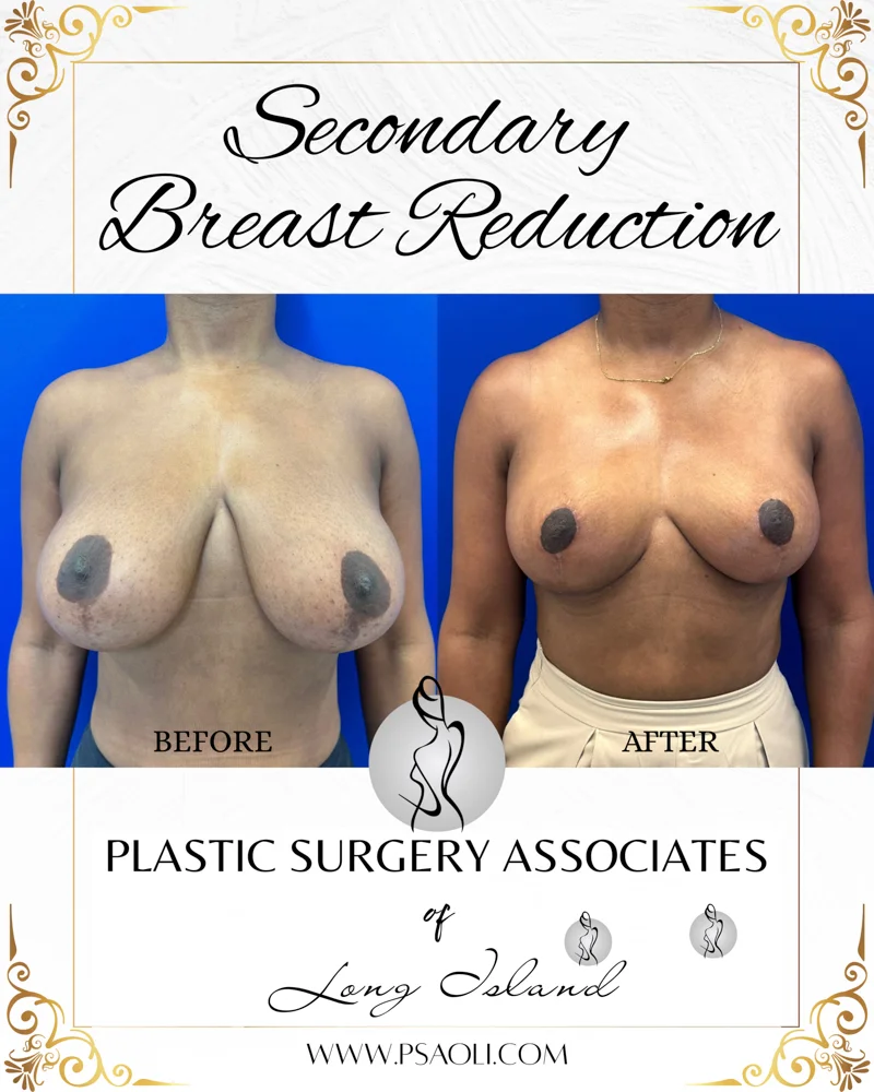 Black and Gold Elegant Bordered Background Instagram Post – 1