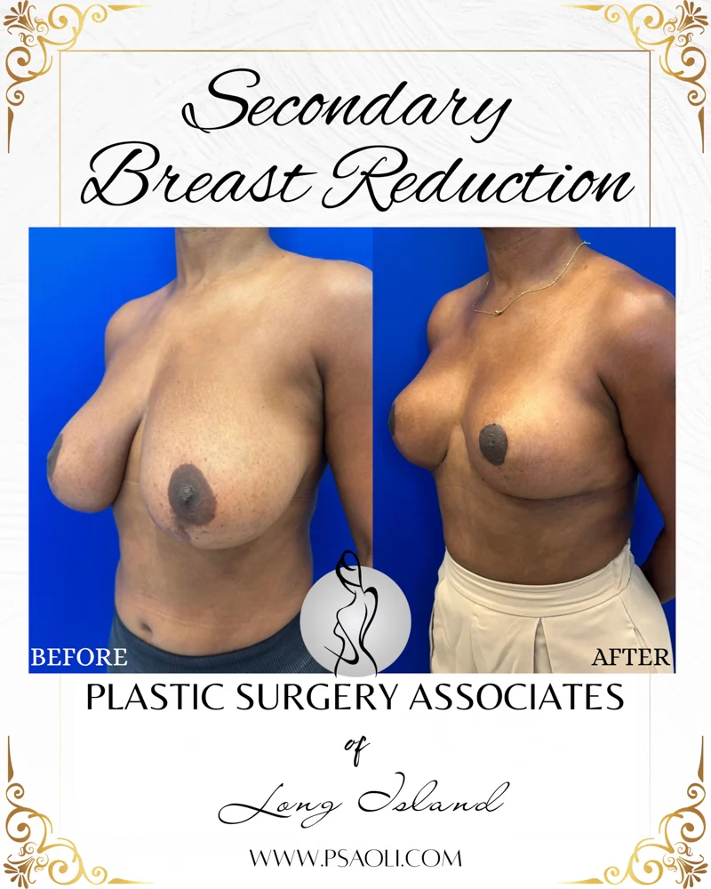 Black and Gold Elegant Bordered Background Instagram Post – 2