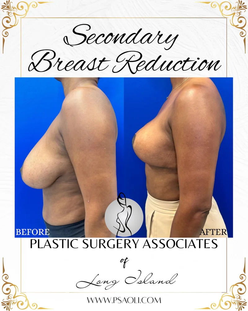 Black and Gold Elegant Bordered Background Instagram Post – 3