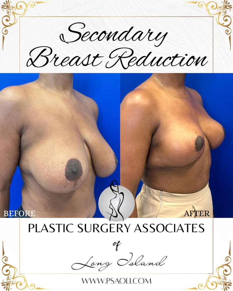 Black and Gold Elegant Bordered Background Instagram Post – 4