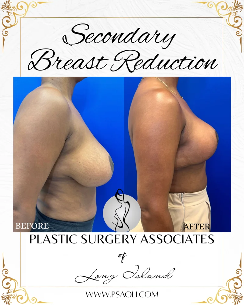 Black and Gold Elegant Bordered Background Instagram Post – 5